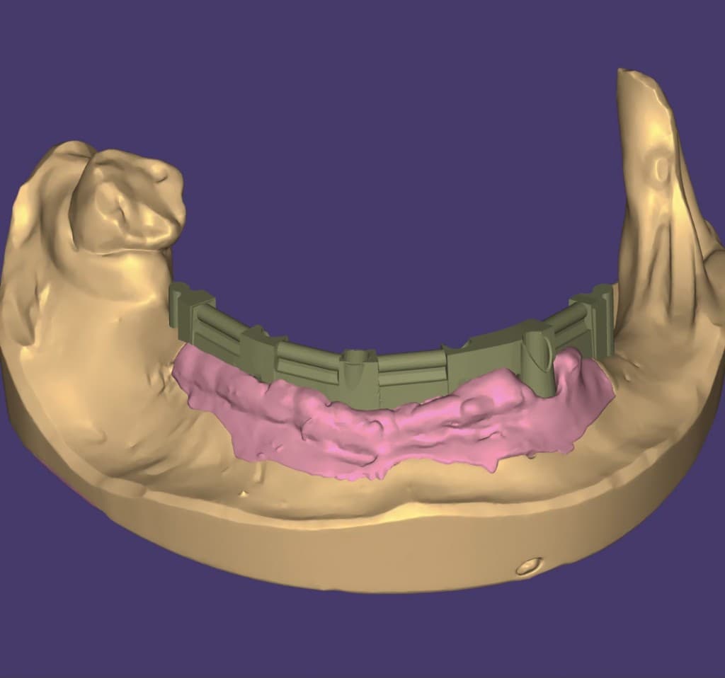 CAD/CAM Fertigung